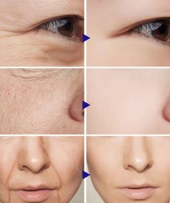 Vitamin C Serum Facial Serum Amazon