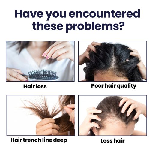 Hair Growth Spray Moisturizes Damaged Hair - Image 3