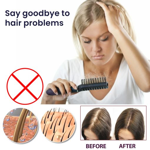 Hair Growth Spray Moisturizes Damaged Hair - Image 6