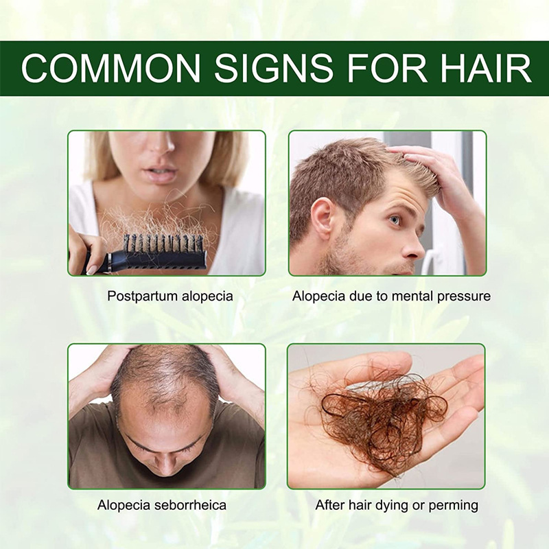 Rosemary Hair Growth - Image 5